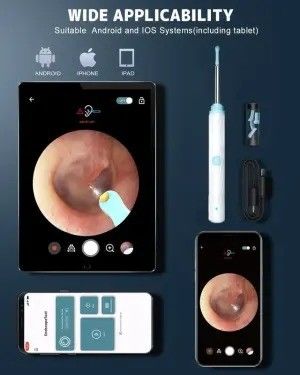 1296P Otoscope Ear Cleaner ক্যামেরা এবং আলো সহ গৃহস্থালি পরিষ্কারের কানের মোম অপসারণ কিট
